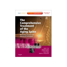 The Comprehensive Treatment of the Aging Spine