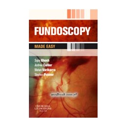 Fundoscopy Made Easy