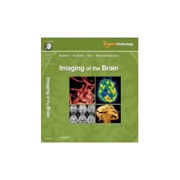 Imaging of the Brain