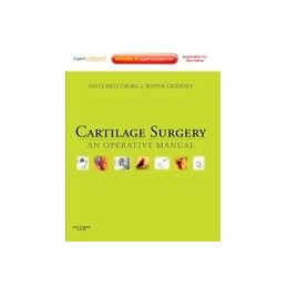 Cartilage Surgery