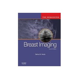 Breast Imaging: The Requisites