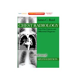 Chest Radiology