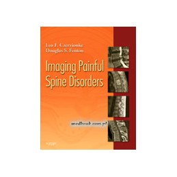 Imaging Painful Spine Disorders