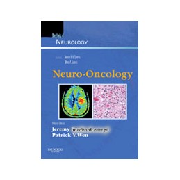 Neuro-Oncology