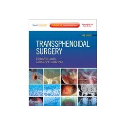 Transsphenoidal Surgery