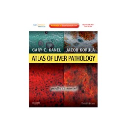 Atlas of Liver Pathology