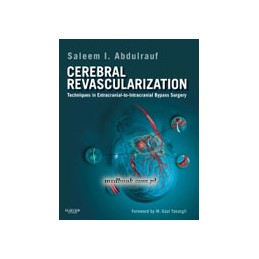 Cerebral Revascularization