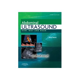 Abdominal Ultrasound