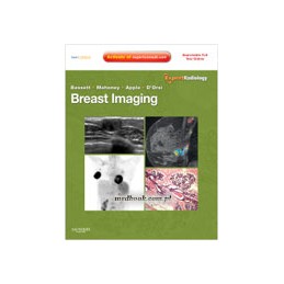 Breast Imaging