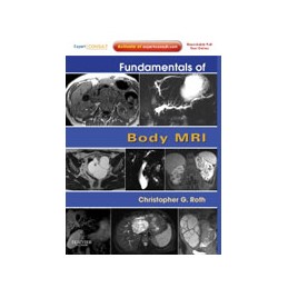 Fundamentals of Body MRI