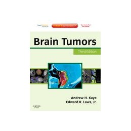 Brain Tumors