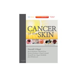 Cancer of the Skin