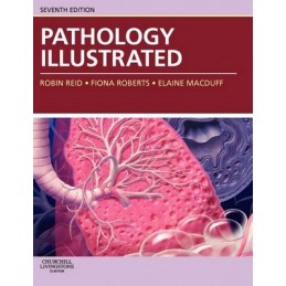 Pathology Illustrated