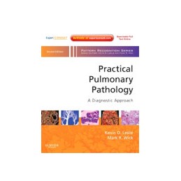 Practical Pulmonary Pathology: A Diagnostic Approach