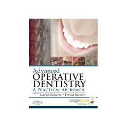 Advanced Operative Dentistry