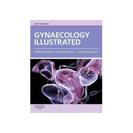 Gynaecology Illustrated