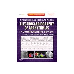 Electrocardiography of...