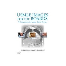 USMLE Images for the Boards