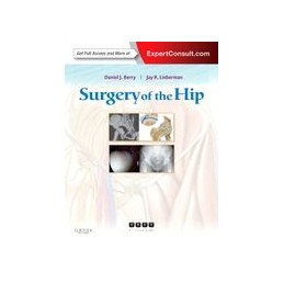 Surgery of the Hip