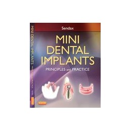 Mini Dental Implants