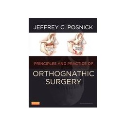 Orthognathic Surgery - 2...