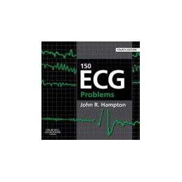 150 ECG Problems