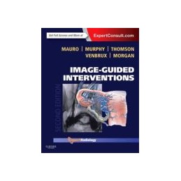 Image-Guided Interventions