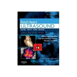 Fetal Heart Ultrasound