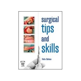 Surgical Tips and Skills