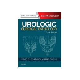 Urologic Surgical Pathology