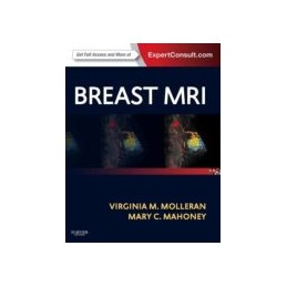 Breast MRI