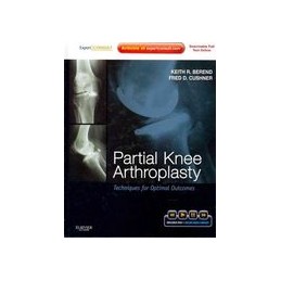 Partial Knee Arthroplasty