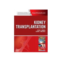 Kidney Transplantation - Principles and Practice