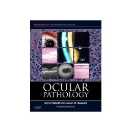 Ocular Pathology