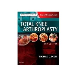 Total Knee Arthroplasty