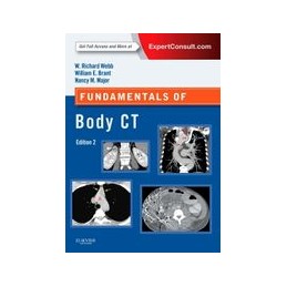 Fundamentals of Body CT