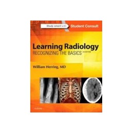 Learning Radiology