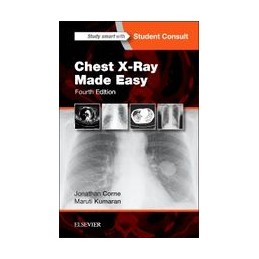 Chest X-Ray Made Easy