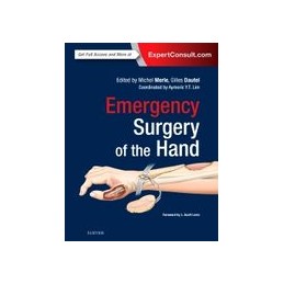 Emergency Surgery of the Hand