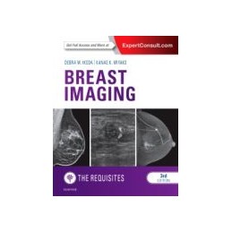 Breast Imaging: The Requisites