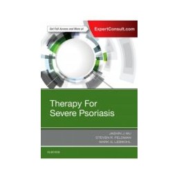 Therapy for Severe Psoriasis