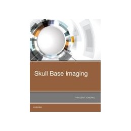 Skull Base Imaging