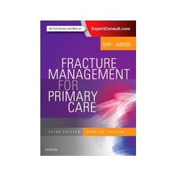 Fracture Management for...