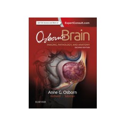 Osborn's Brain