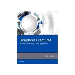 Scaphoid Fractures