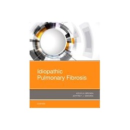 Idiopathic Pulmonary Fibrosis