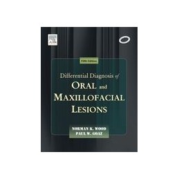 Differential Diagnosis of Oral and Maxillofacial Lesions