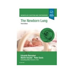 The Newborn Lung