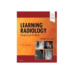 Learning Radiology