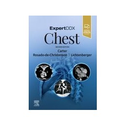 ExpertDDx: Chest